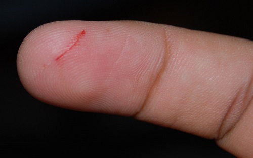 دلیل درد زیاد ناشی از بریدن انگشت با کاغذ